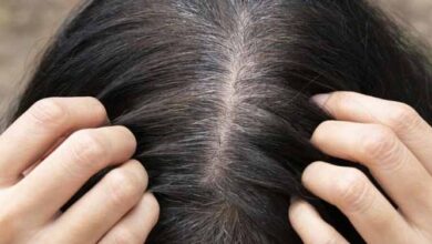 موهای در حال سفید شدن