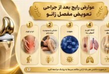عوارض رایج بعد از جراحی تعویض مفصل زانو