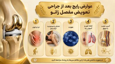 عوارض رایج بعد از جراحی تعویض مفصل زانو